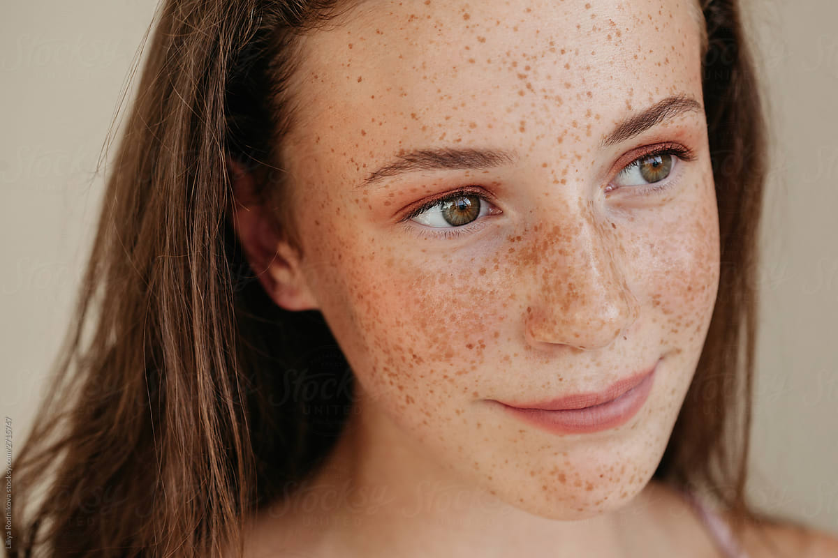 Crop Face Natural Beauty Portrait Of Smiling Girl With Freckles By 