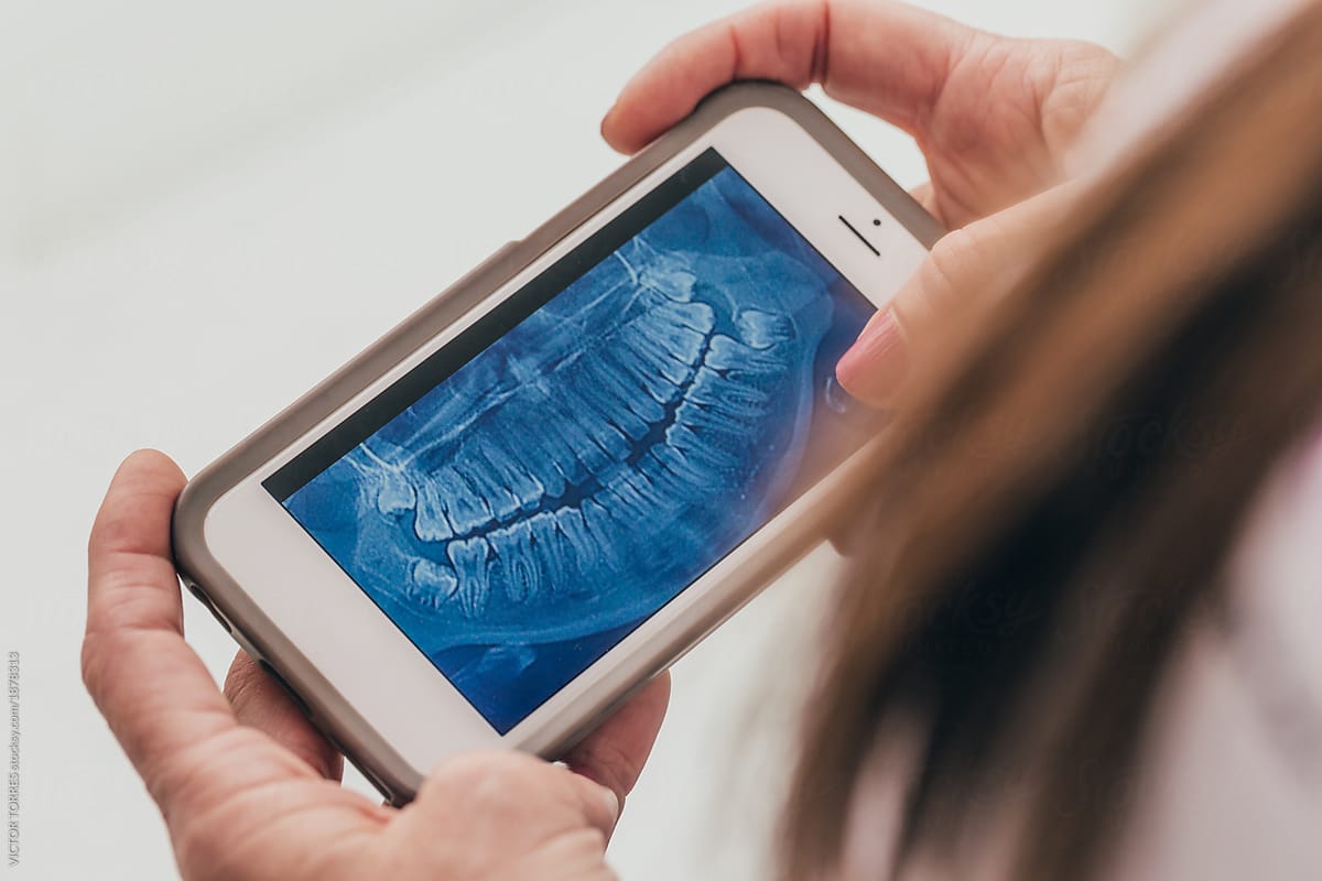 Dentist examining an x-ray on a mobile phone