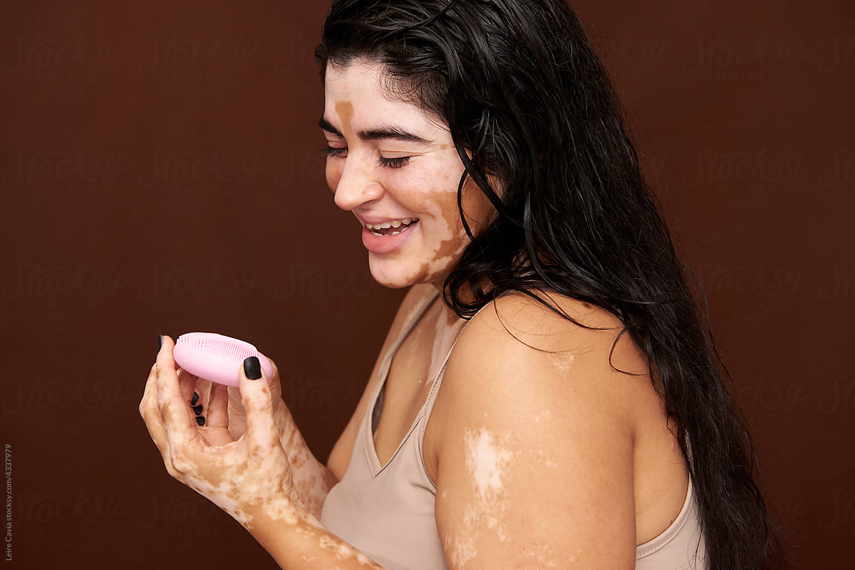 Vitiligo skin girl using a face cleanser device