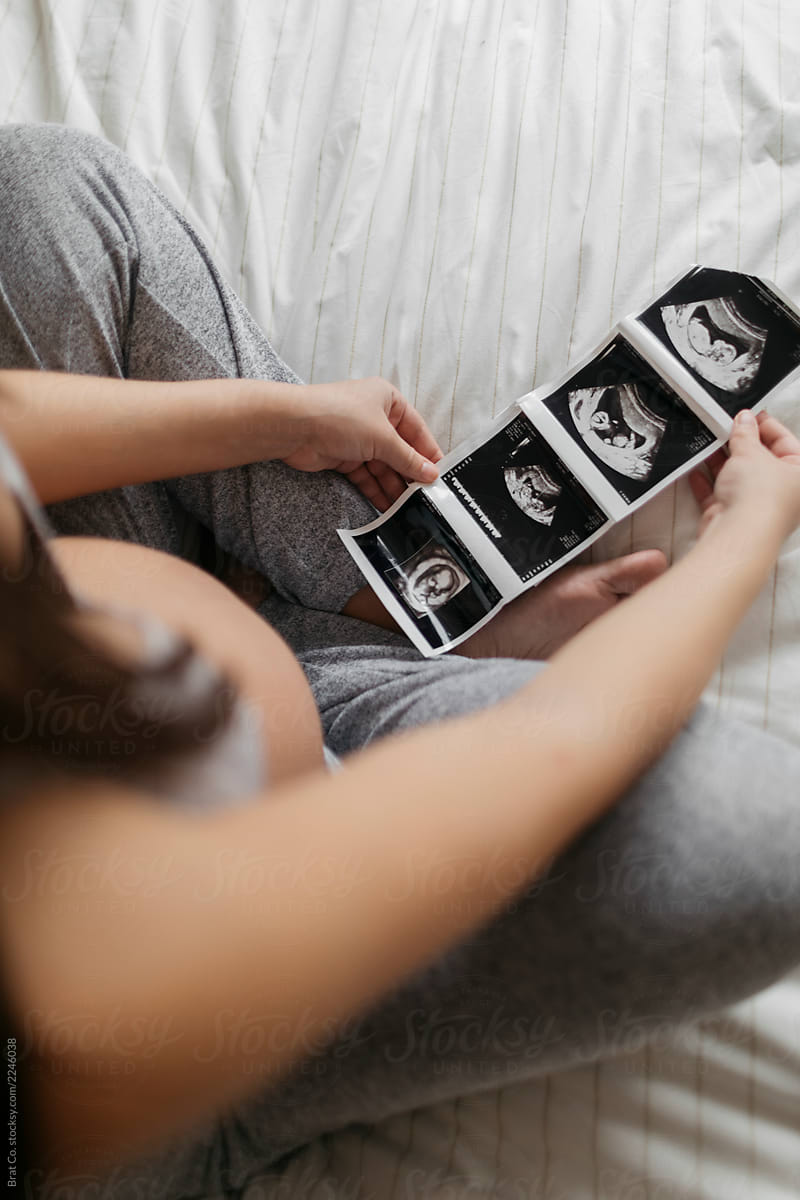 Young Pregnant Woman with Ultrasound photos