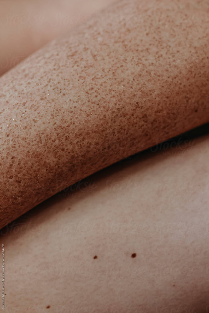 Close-up women\'s arms  in freckles skin texture