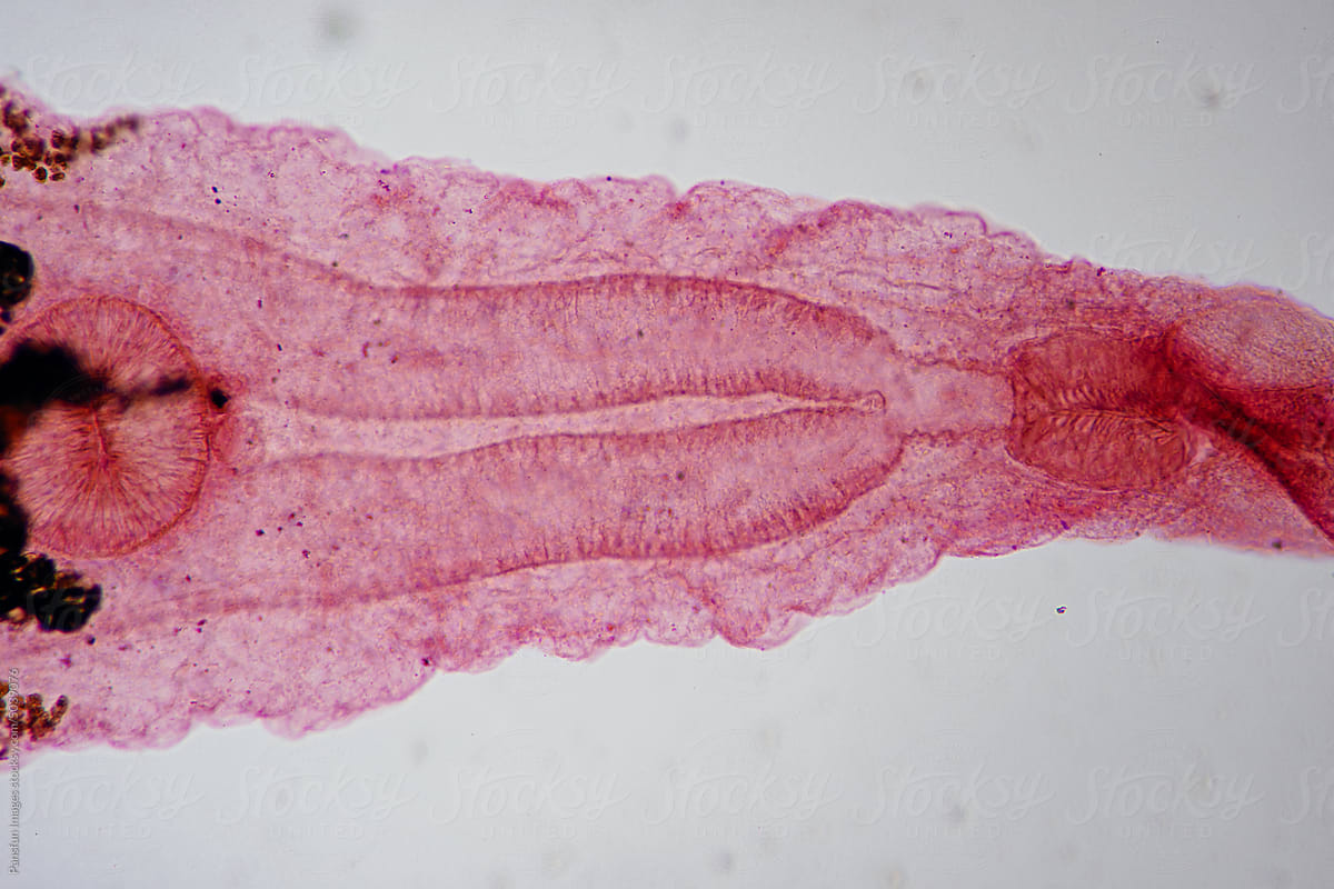 Clonorchis sinensis adults micrograph