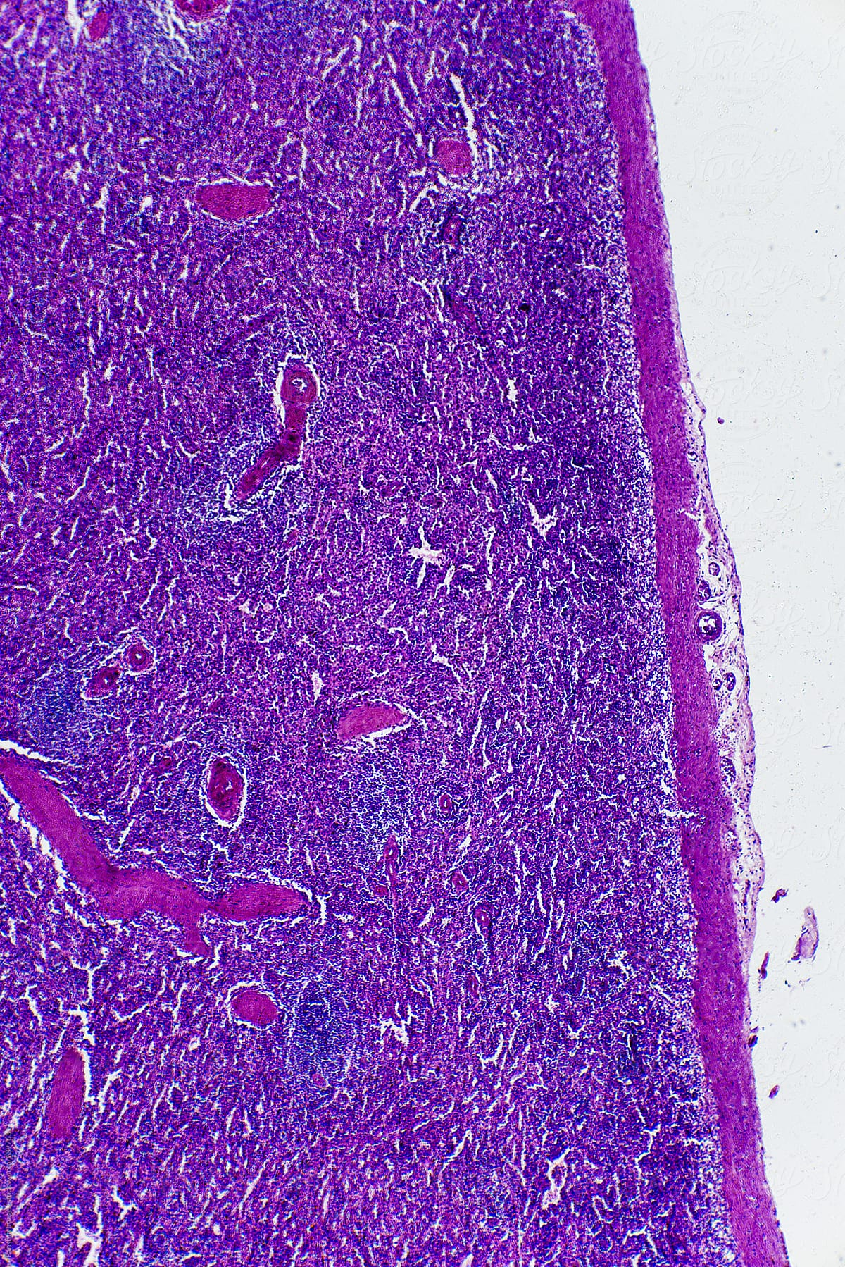 Central antery hyaline degene of human spleen