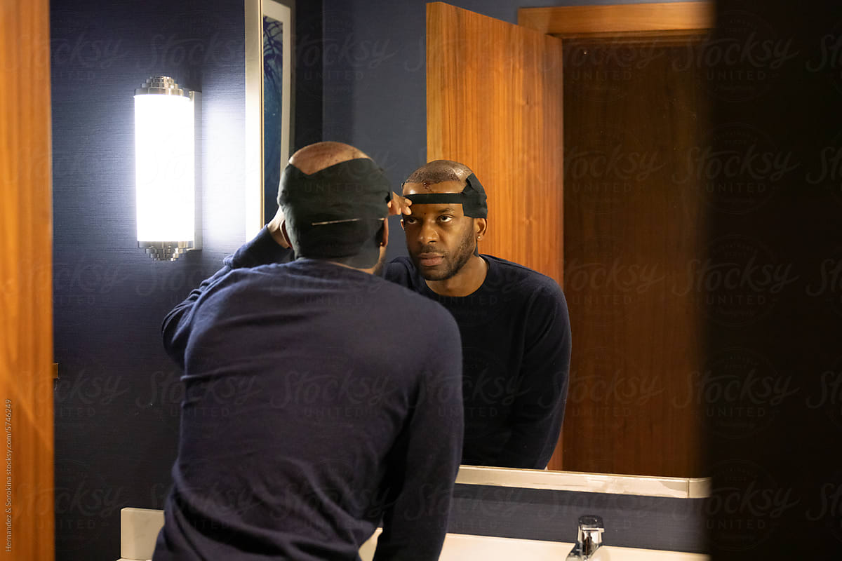 Man Looking To The Mirror After Hair Transplantation