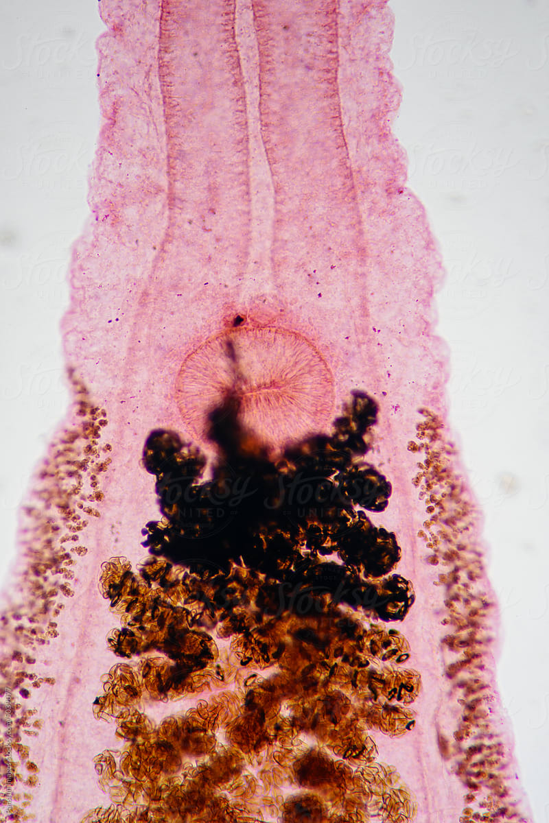 uterus of Clonorchis sinensis adults micrograph