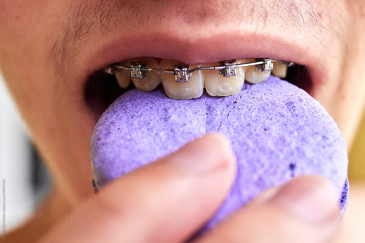 Guy in braces eats a purple cake