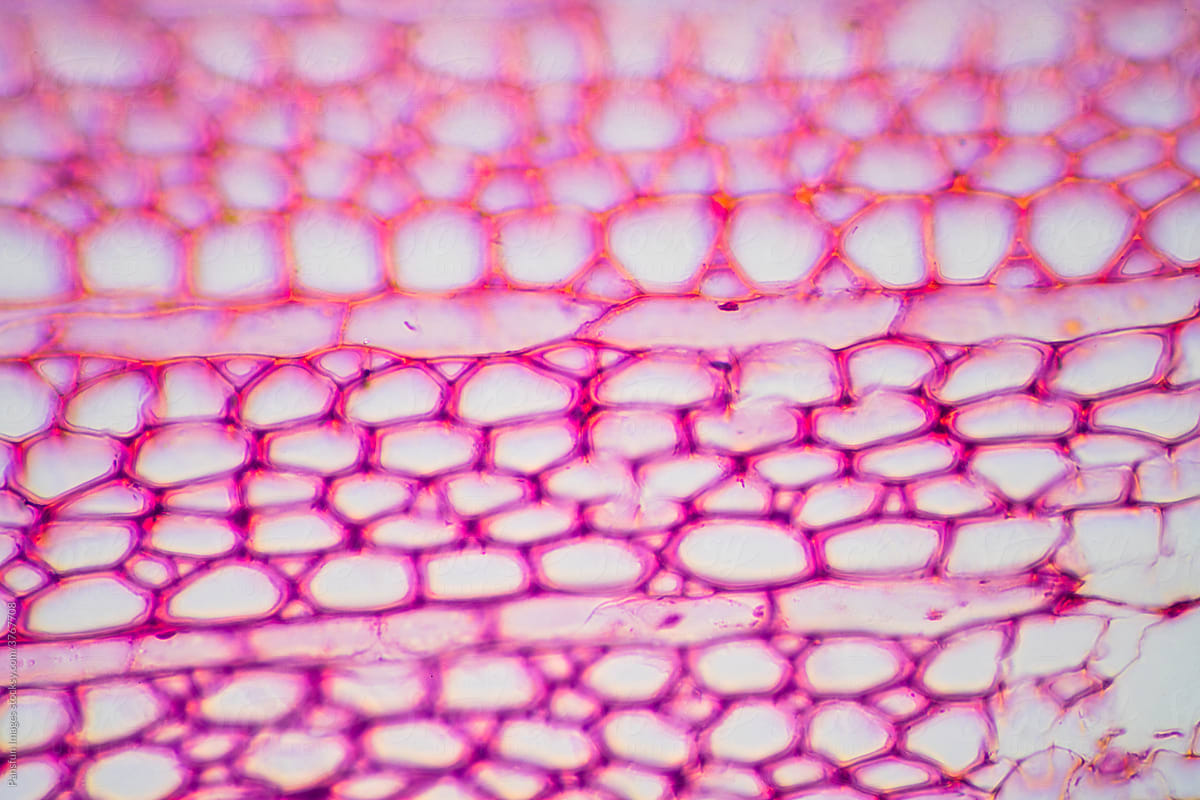 Agarwood plant cells micrograph