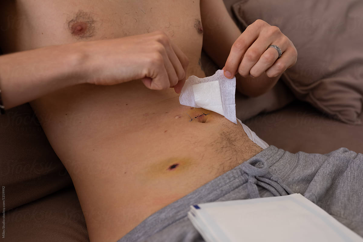 Shirtless man changing sterile bandage on belly