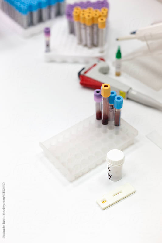 Helicobacter pylori rapid test on a lab\'s table showing negative result