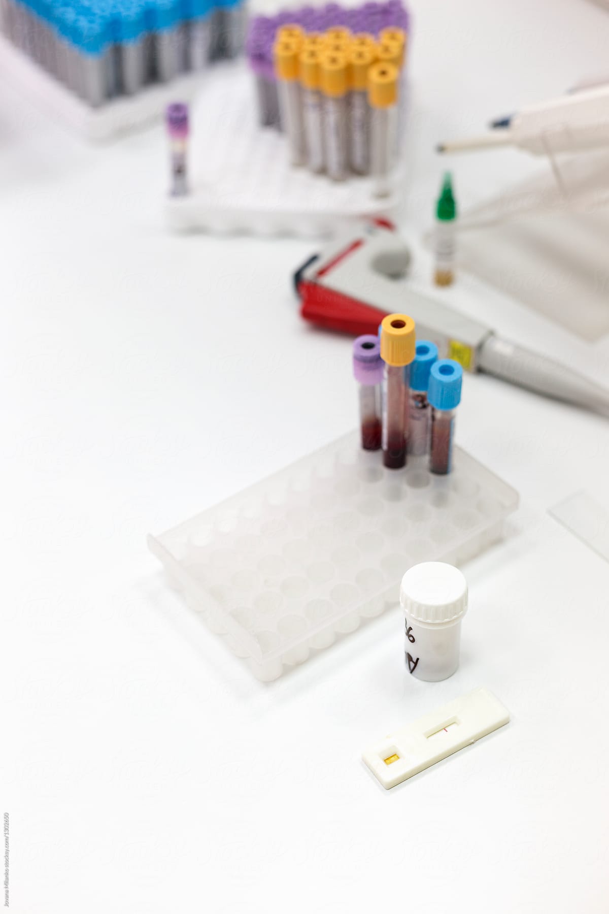 Medical Laboratory Tests on White Desk