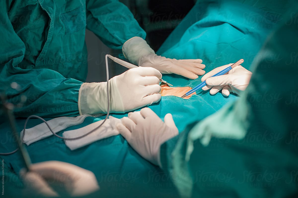 Close Up of a Surgeon Operating on a Patient