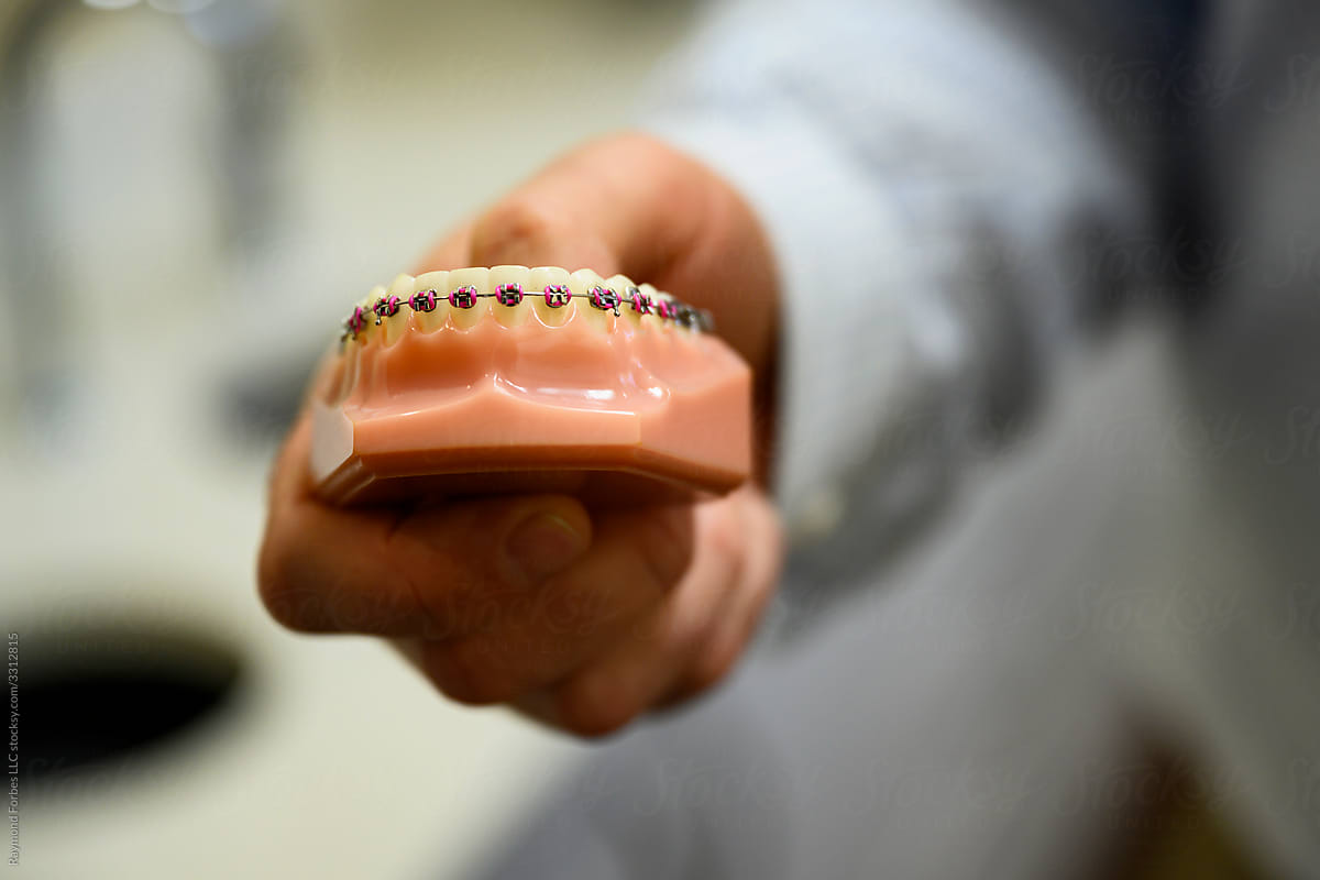 Orthodontist Holding Dental Mold with Braces