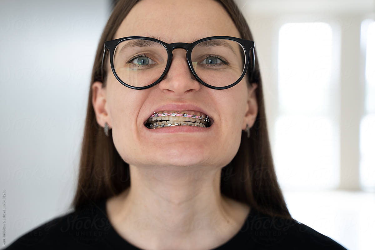 Young Woman Smiling with Braces and Glasses. Self-confident female