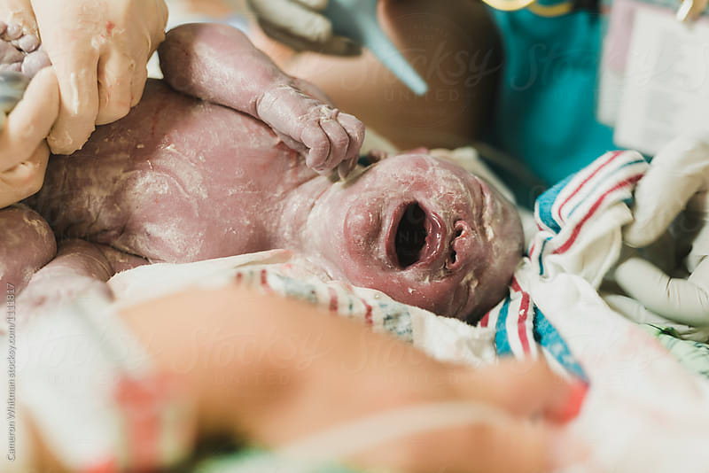 Newborn baby moments after delivery