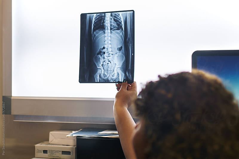 X-Ray image of coin inside boy's stomach