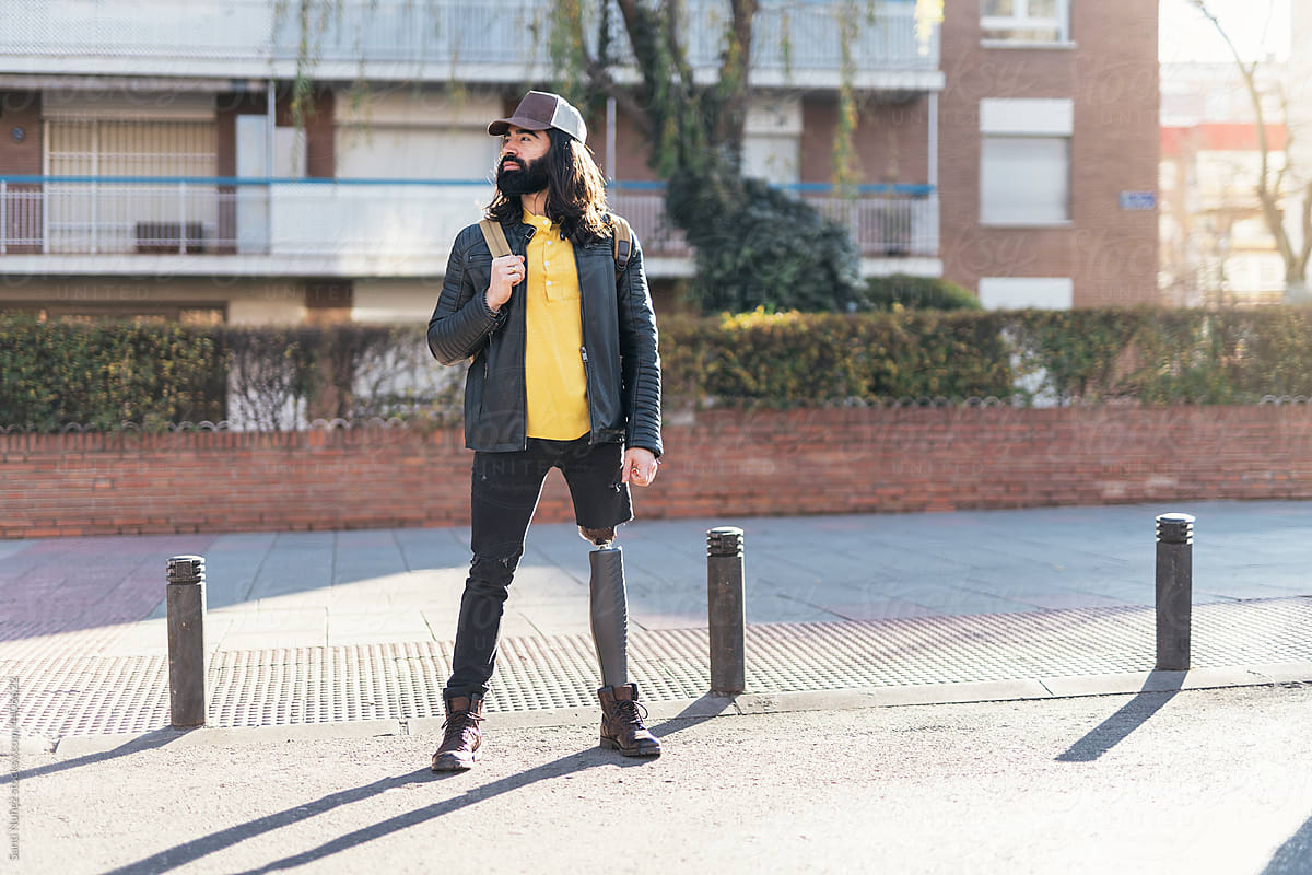 Guy with prosthetic leg standing on street