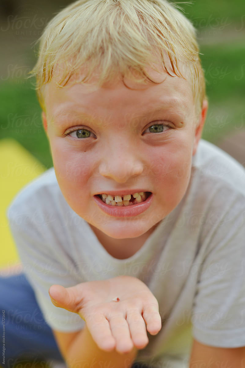 A kid with his first loose tooth