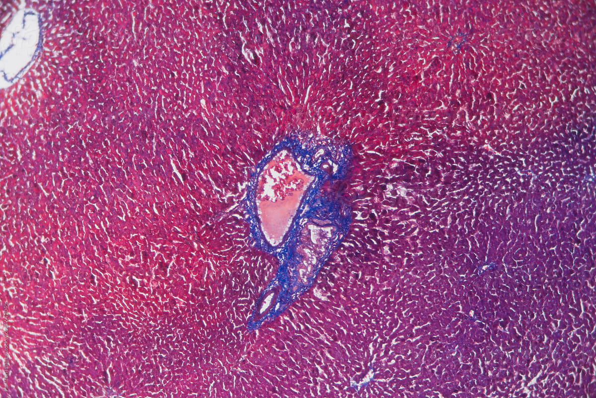 animal cells of rat liver tissue micrograph