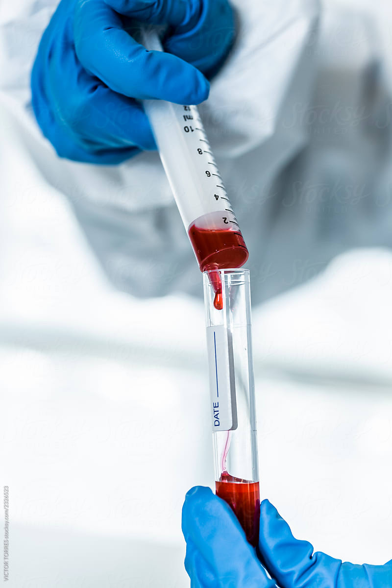 Biologist working with blood samples in the lab