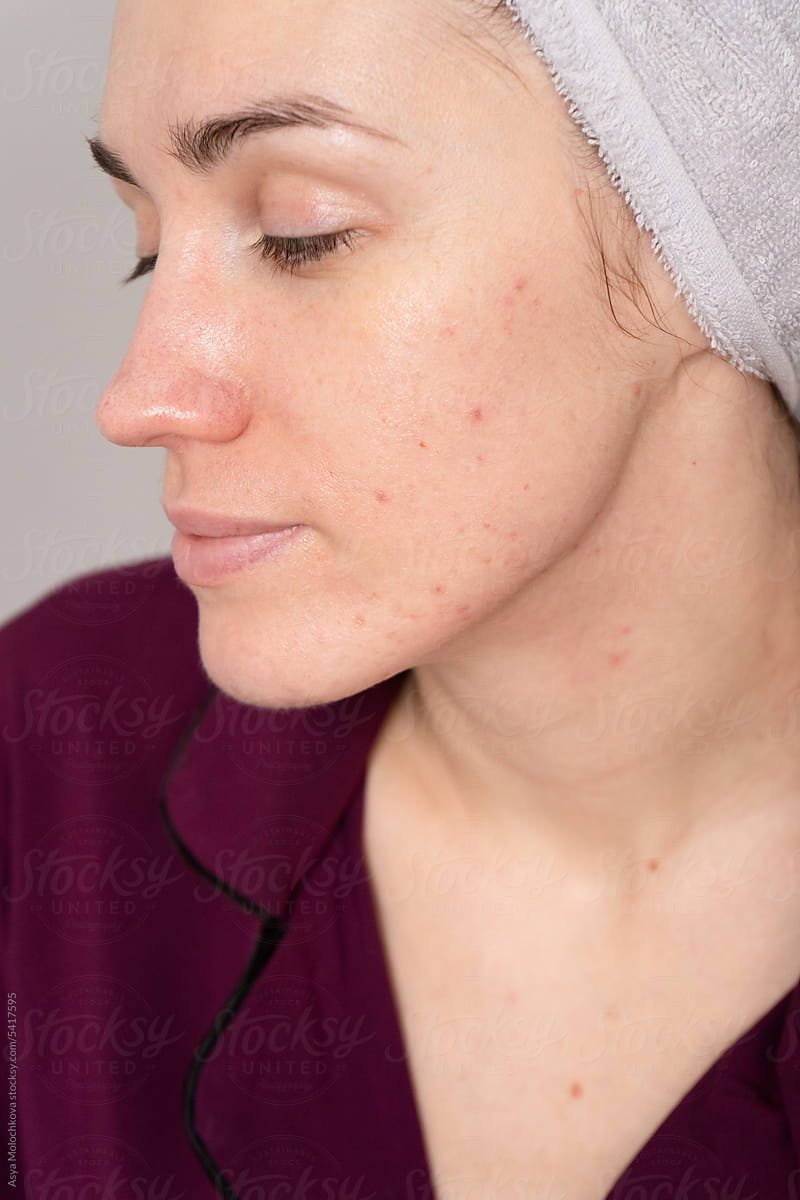 Relaxed young woman with natural skin