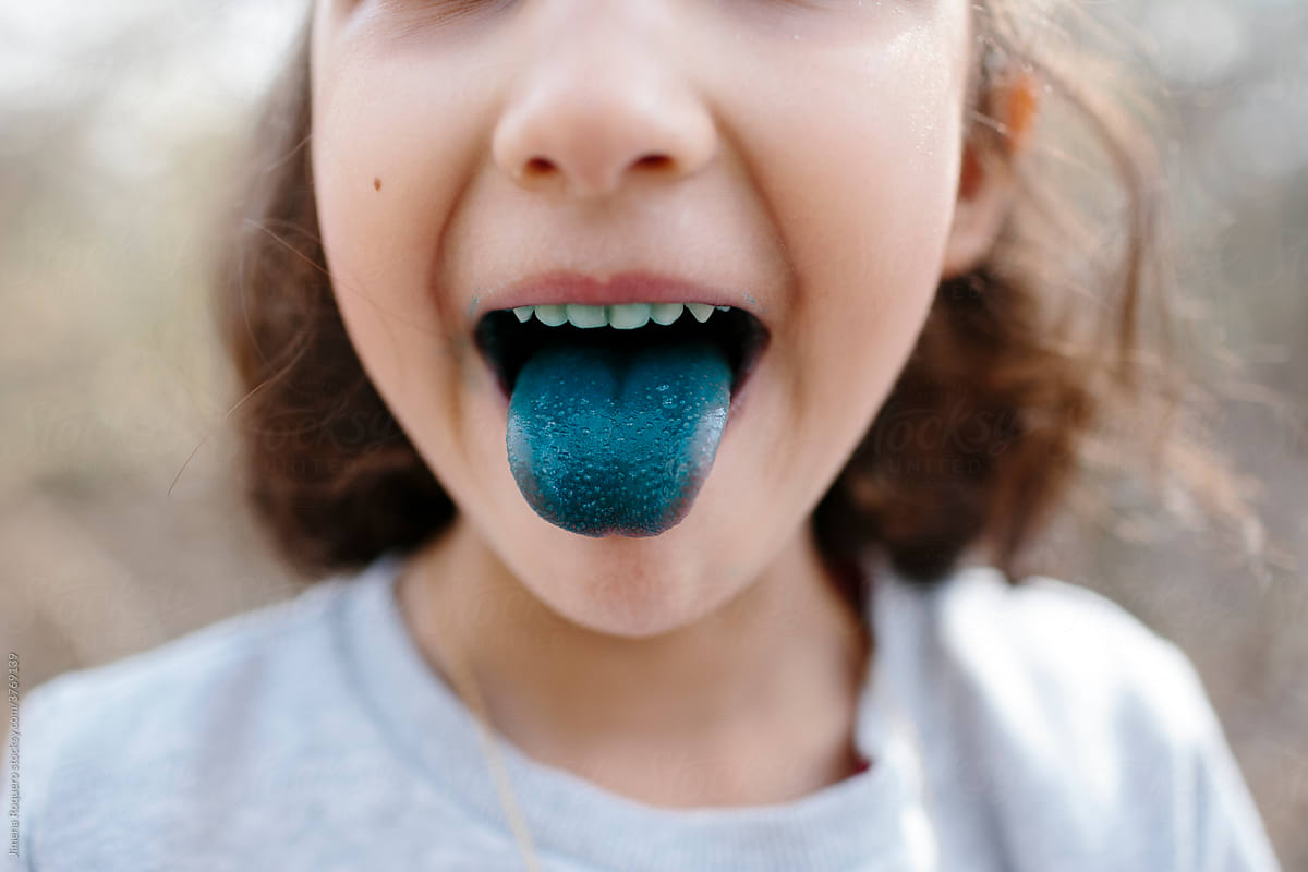 Blue tongue