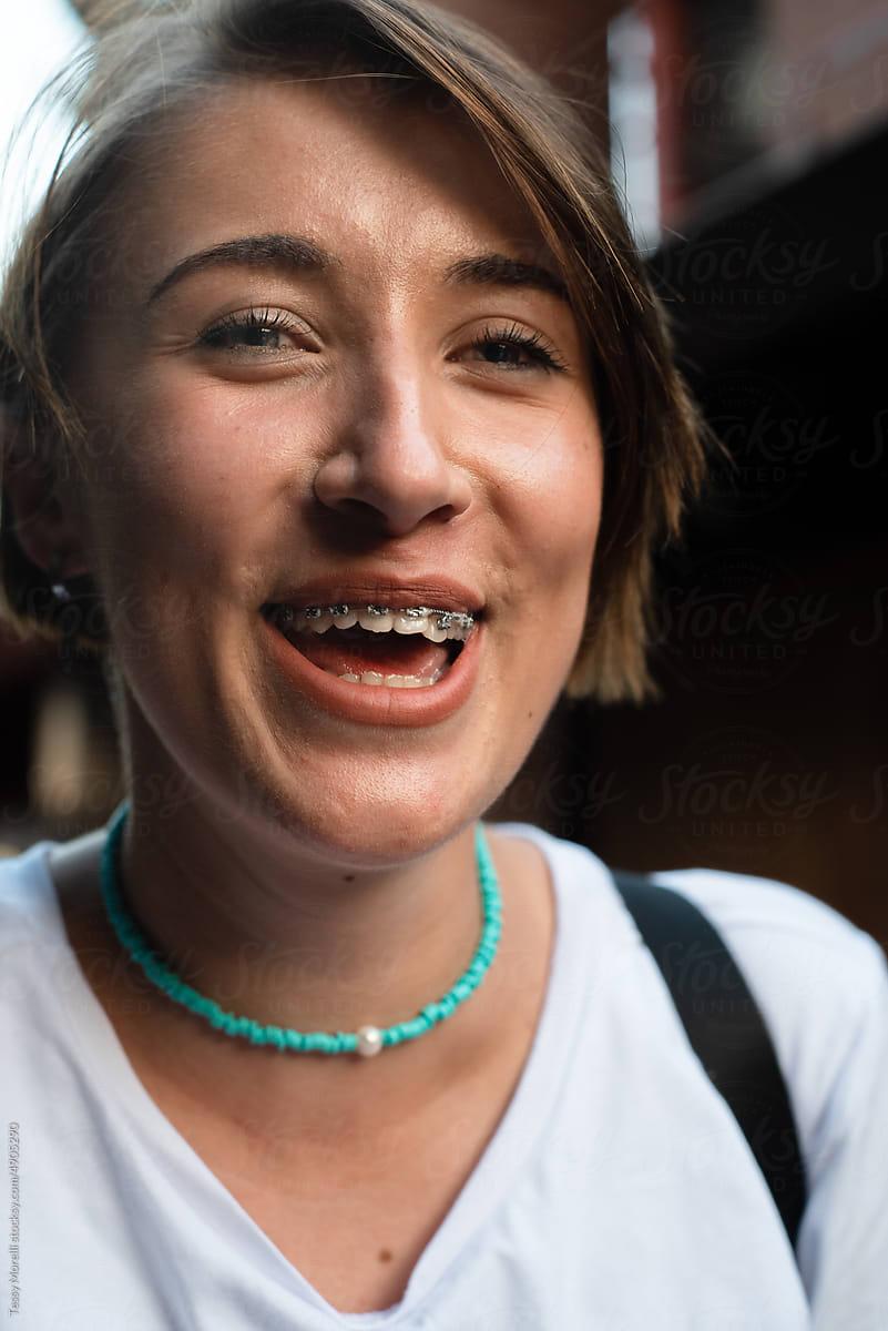 Close portrait of happy woman with braces laughing and smiling