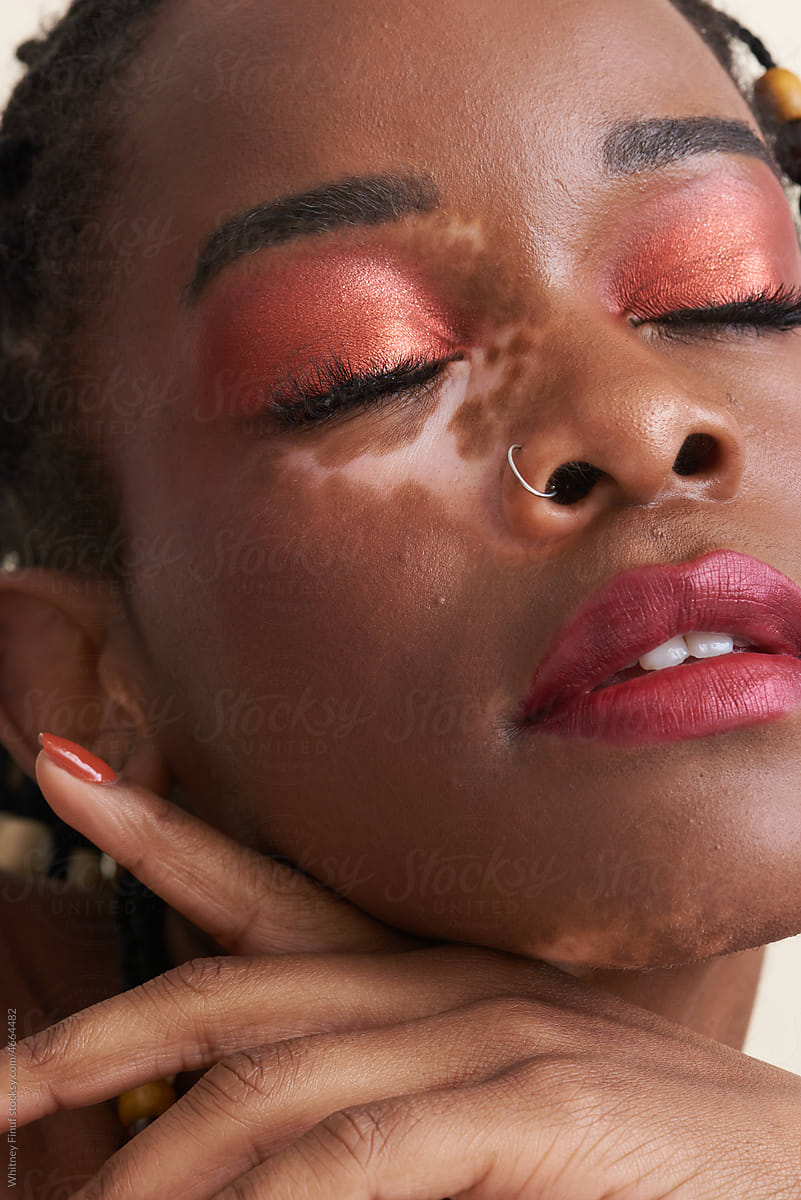 Close Up Portrait of Black Woman with Vitiligo with Closed Eyes