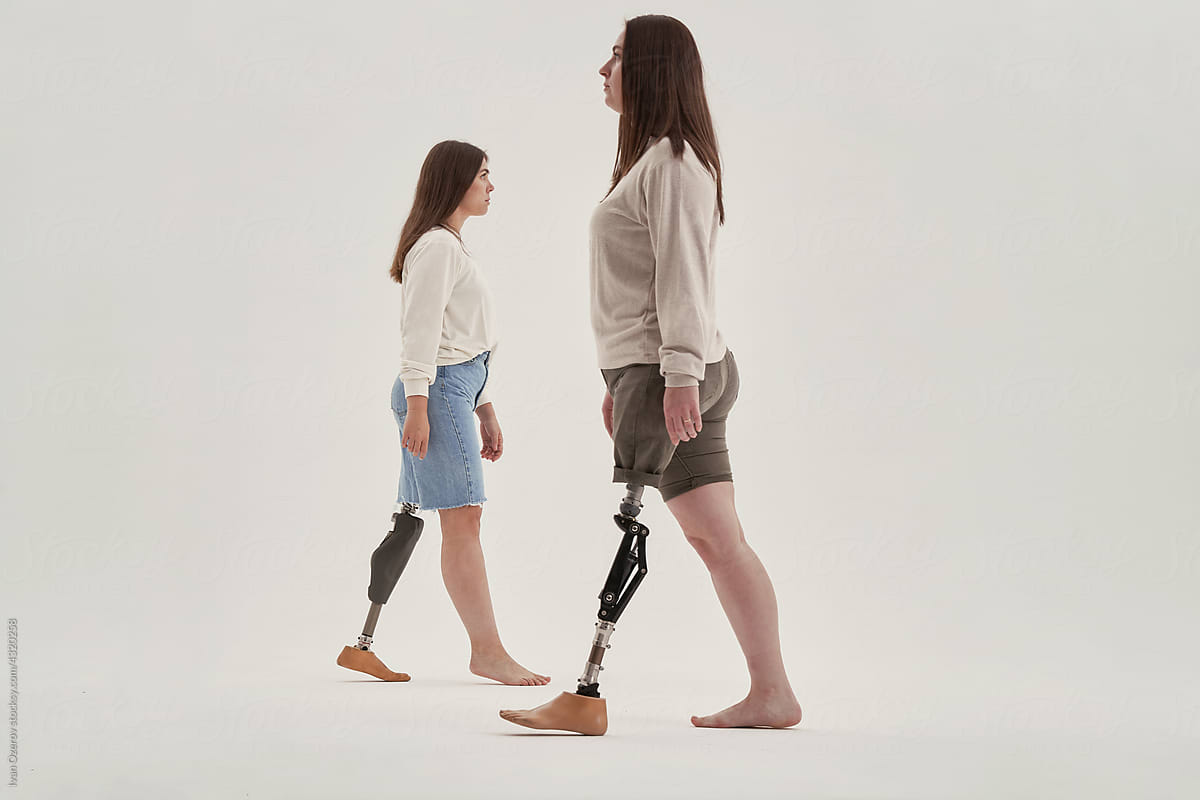 Positive Handicapped Woman Bending To Prosthetic Leg by Stocksy  Contributor Ivan Ozerov - Stocksy