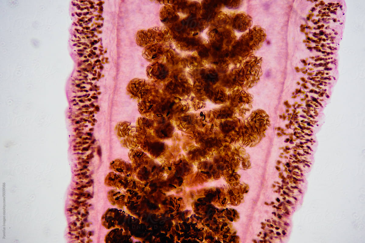 uterus of Clonorchis sinensis adults micrograph