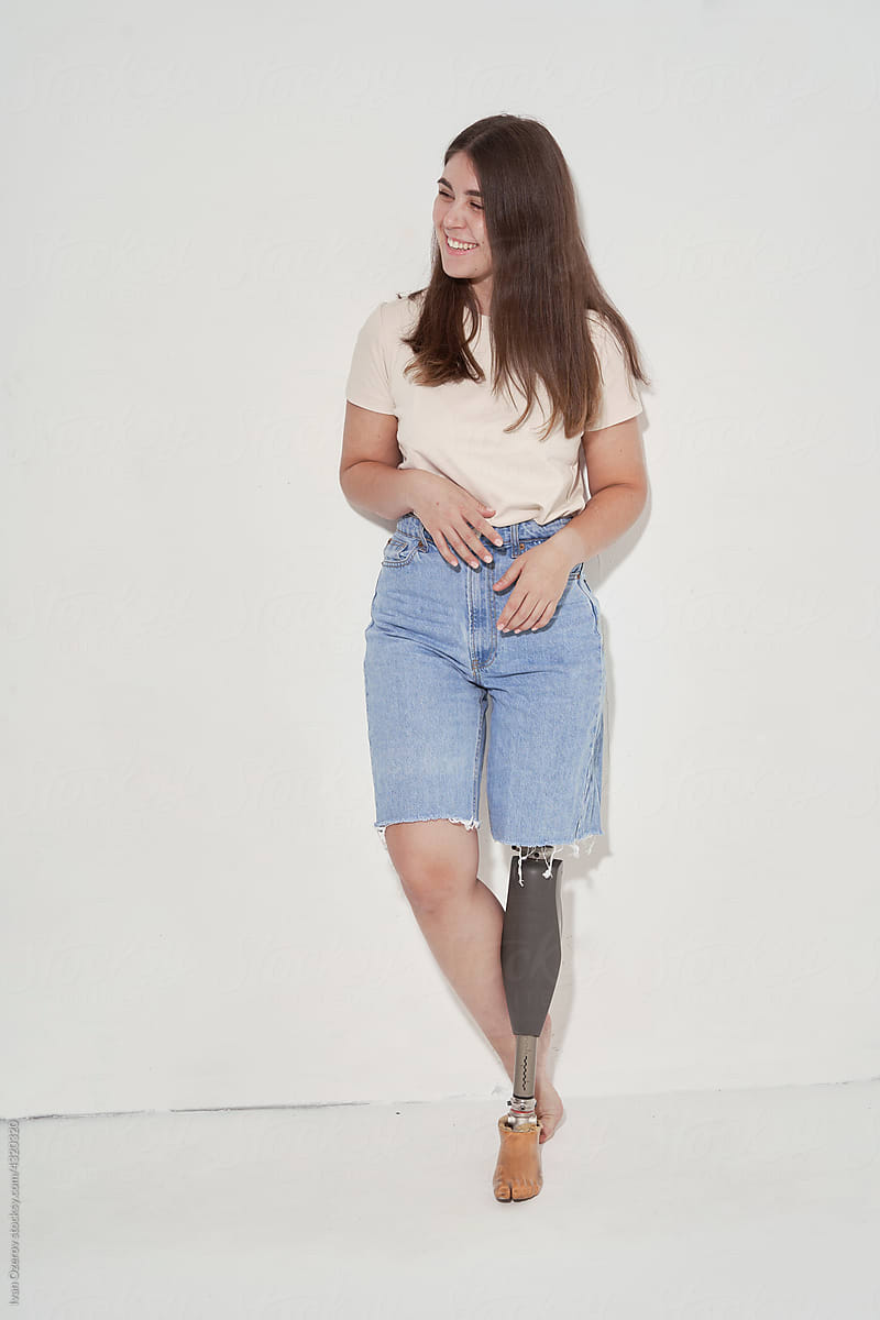 Positive Handicapped Woman Bending To Prosthetic Leg by Stocksy  Contributor Ivan Ozerov - Stocksy