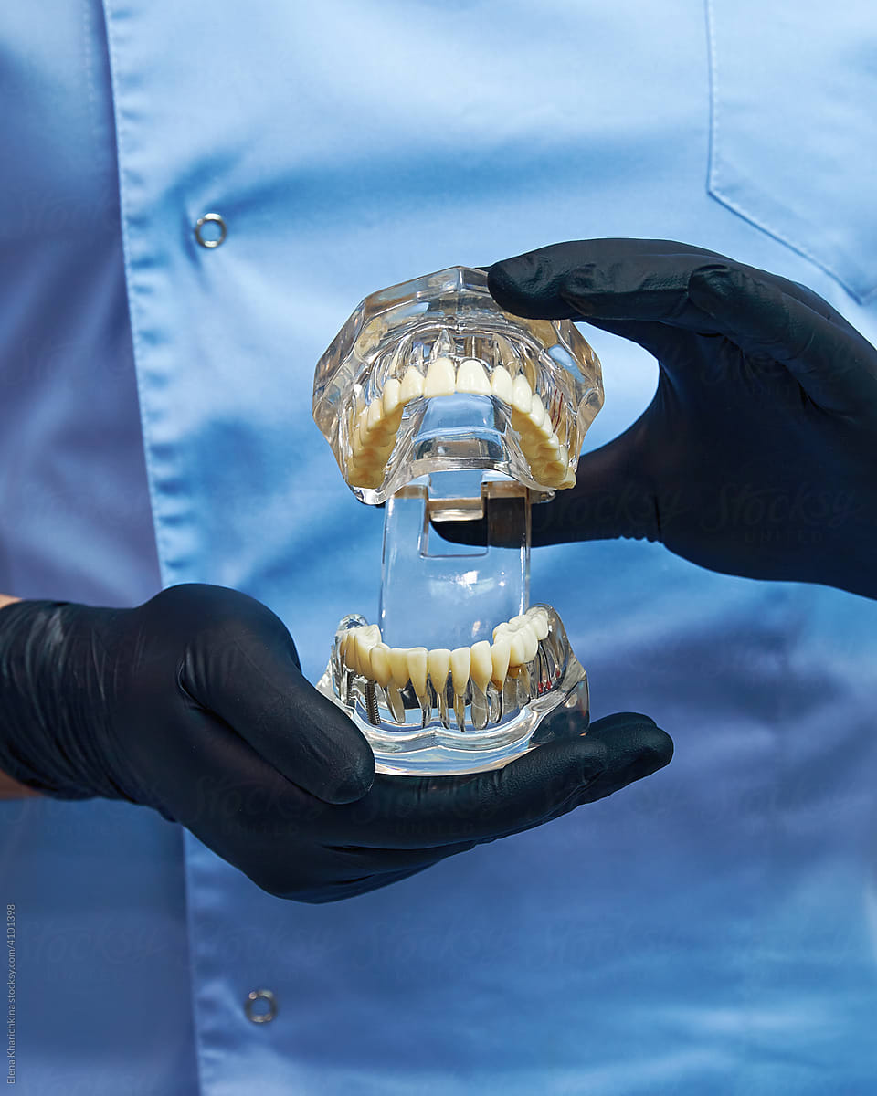 Jaw model in the hands of a doctor