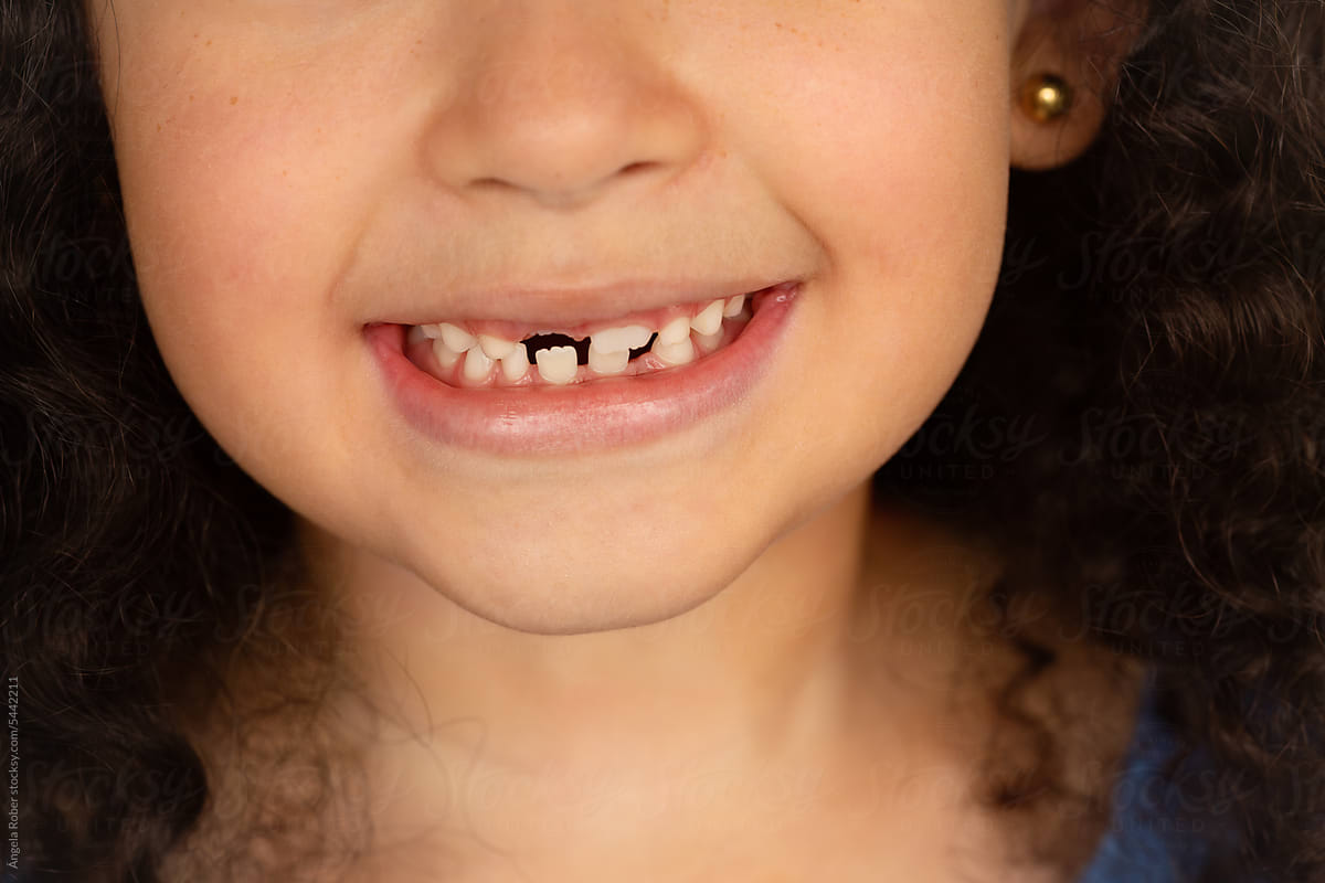 Close-up of an unrecognizable girl showing a missing tooth
