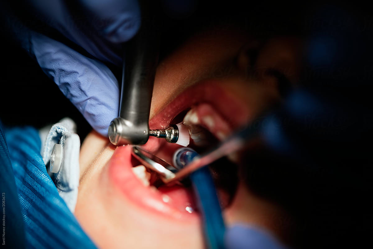 Dentist working on child teeth