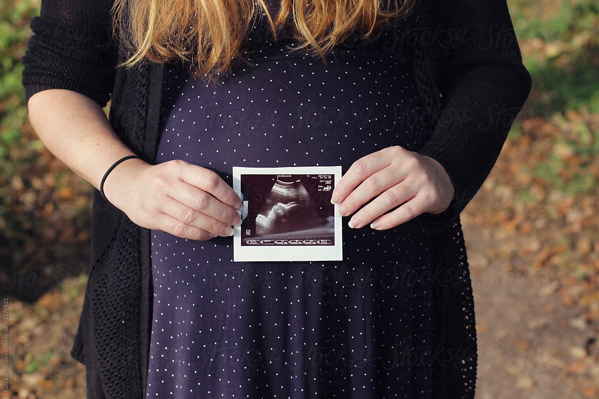 Pregnant woman holding sonogram image