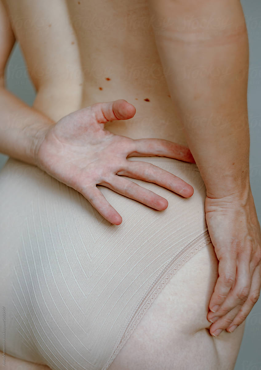 Detail of a woman\'s naked back with a hand on her thigh with a scar