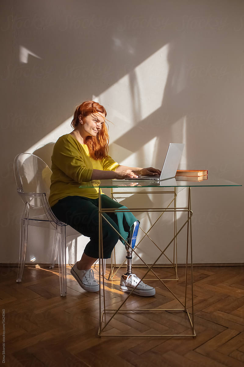 A bright woman with a prosthetic leg in a home office with a laptop