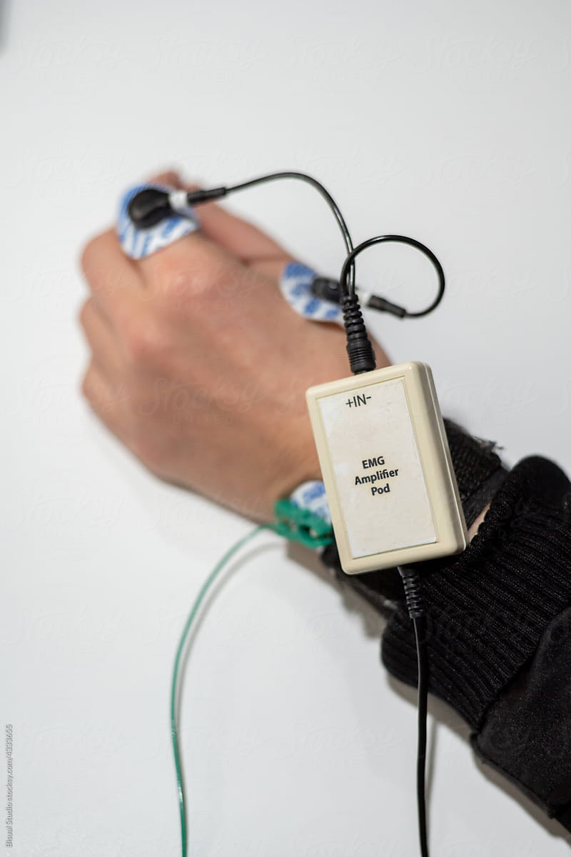Patient with hand sensors for checking nerve cells brain
