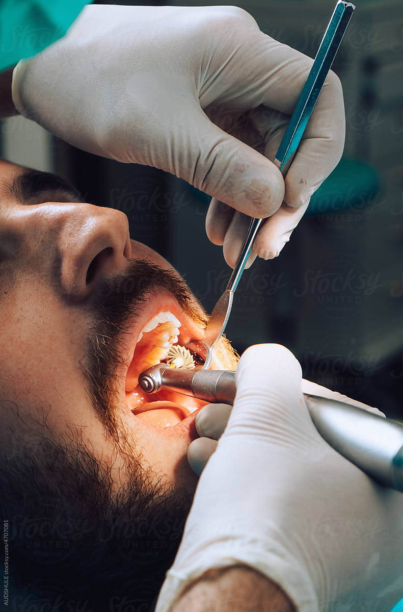 Detail  patient teeth during dental surgery