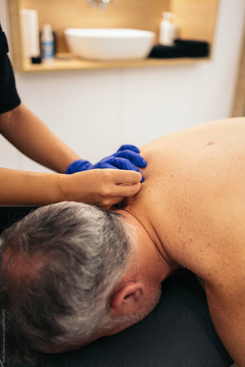 Physiotherapist giving dry needling treatment to a patient