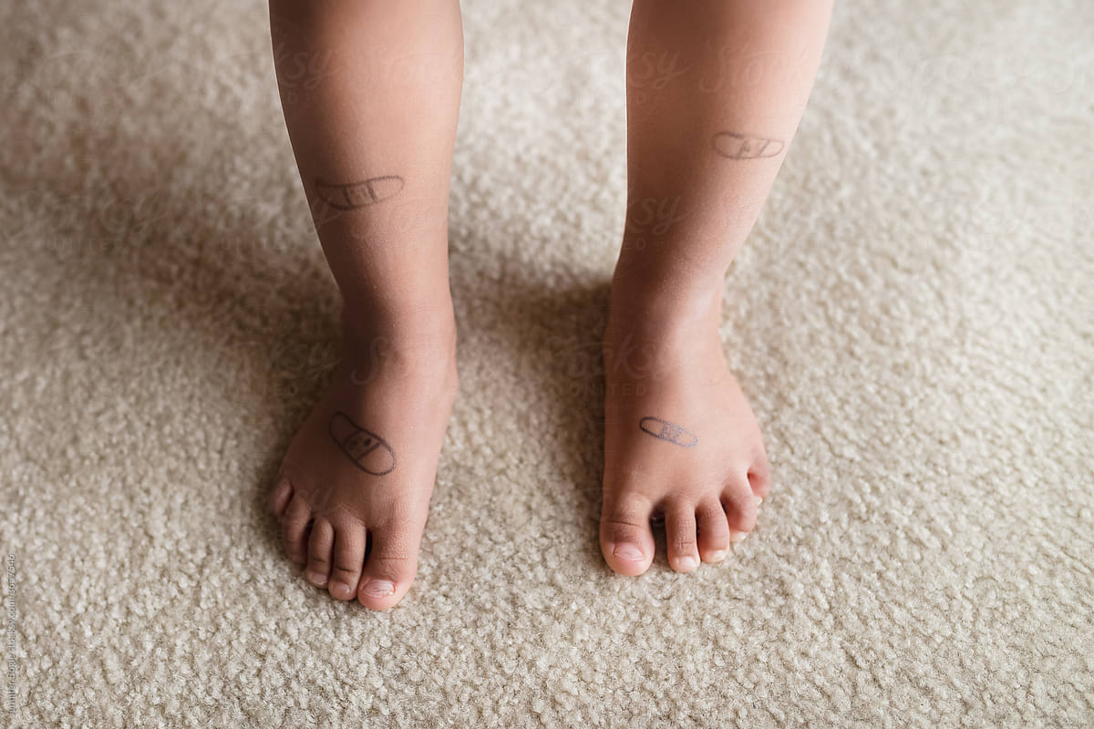 Child with bandages drawn on feet