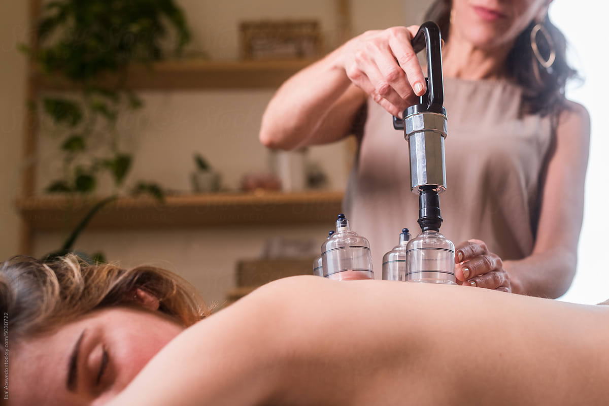 Lying woman receiving alternative cupping therapy