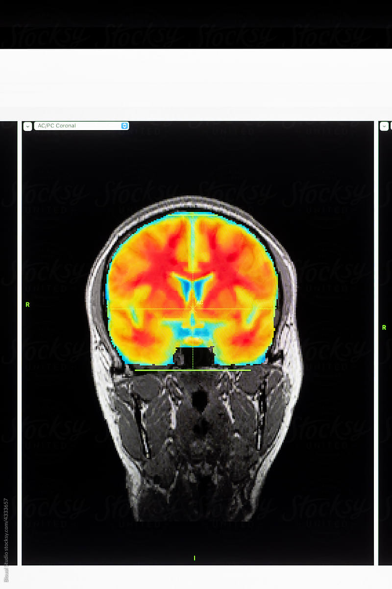 Colorful scan of brain on screen computer