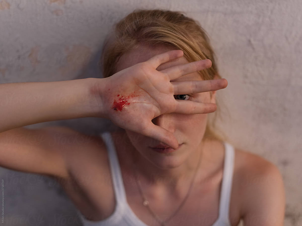 Young woman with bleeding hand