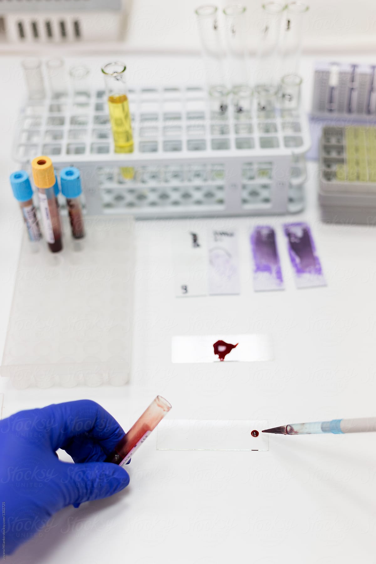 Blood Sample Testing in Laboratory