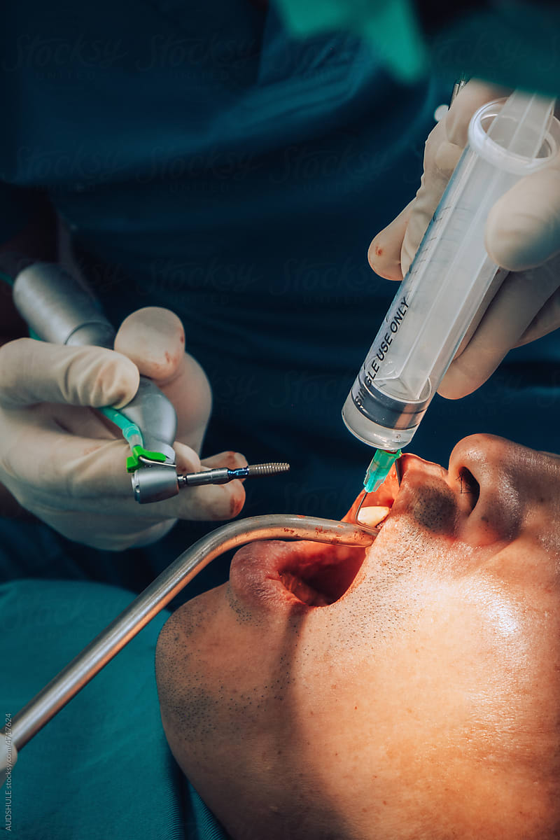 Details during dental surgery