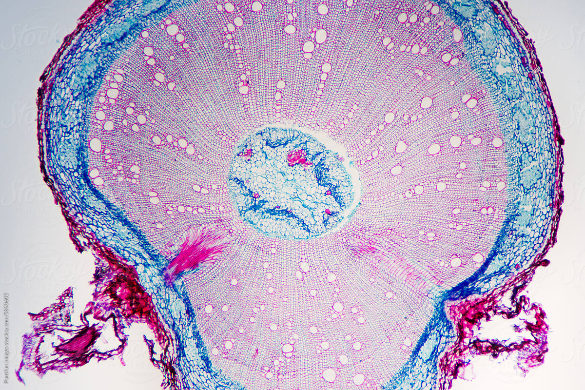 Chinese starjasmine stem plant cells micrograph