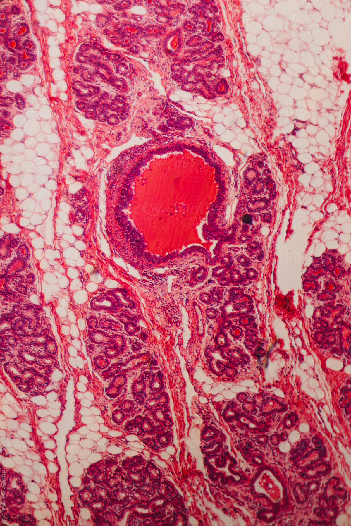 Adipose fat cell of animal pig.