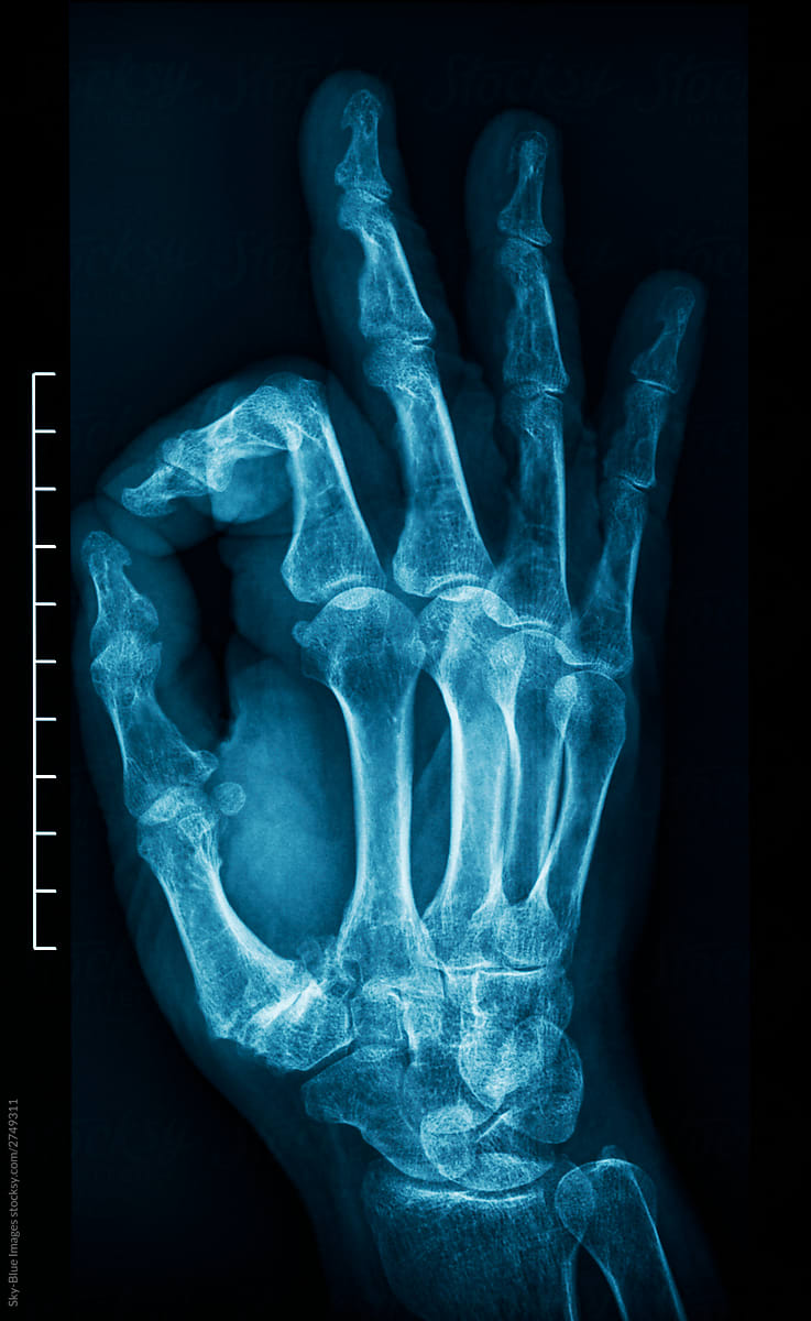 X-ray of an human hand doing the OK sign with the fingers