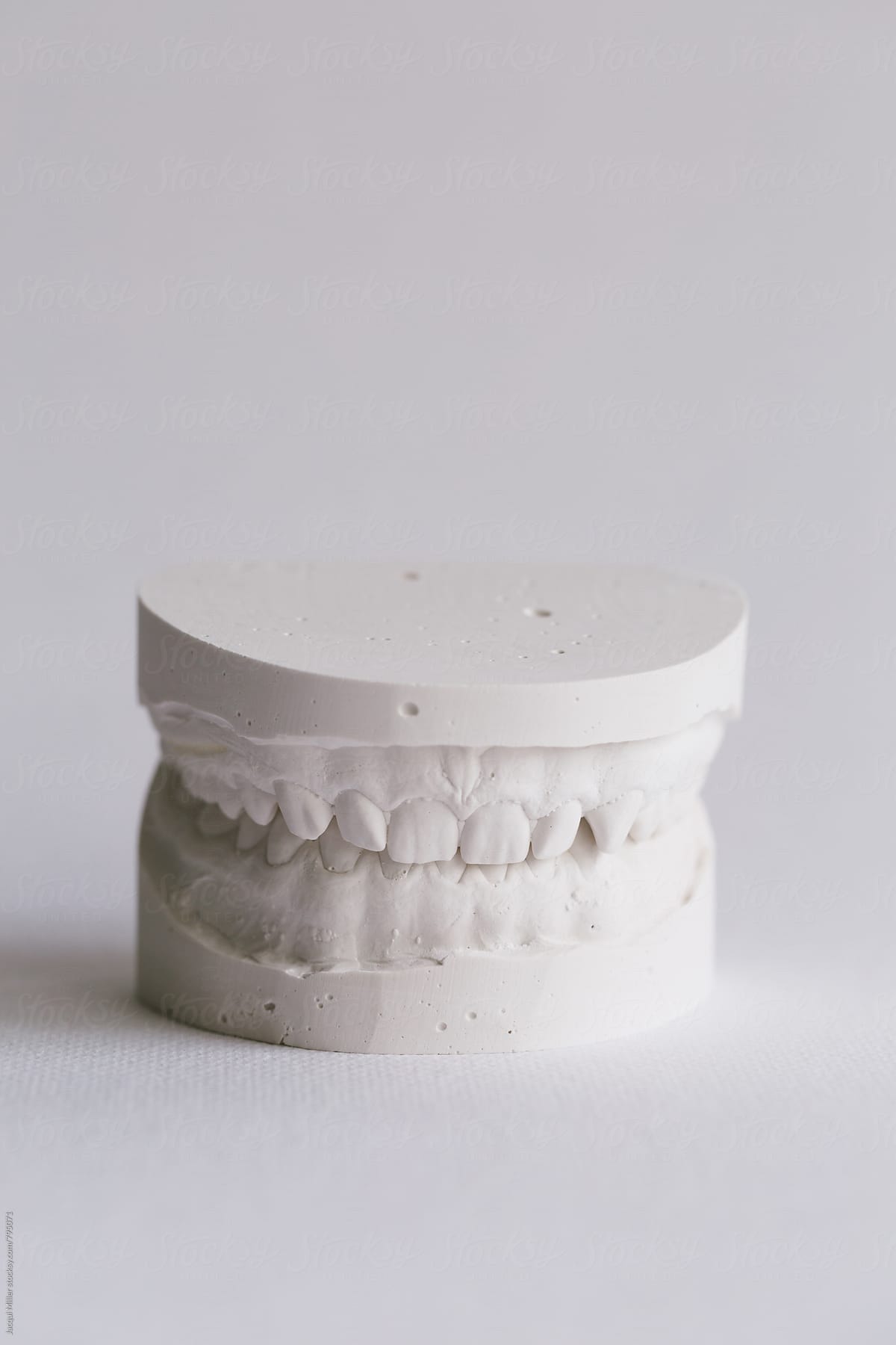 Plaster models of upper and lower teeth