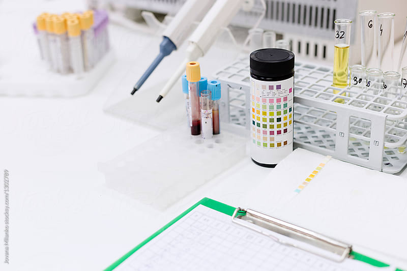 Clinical urine test in a laboratory